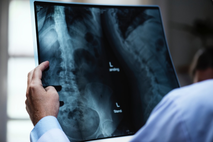 someone looking at
a x-ray of a backbone
